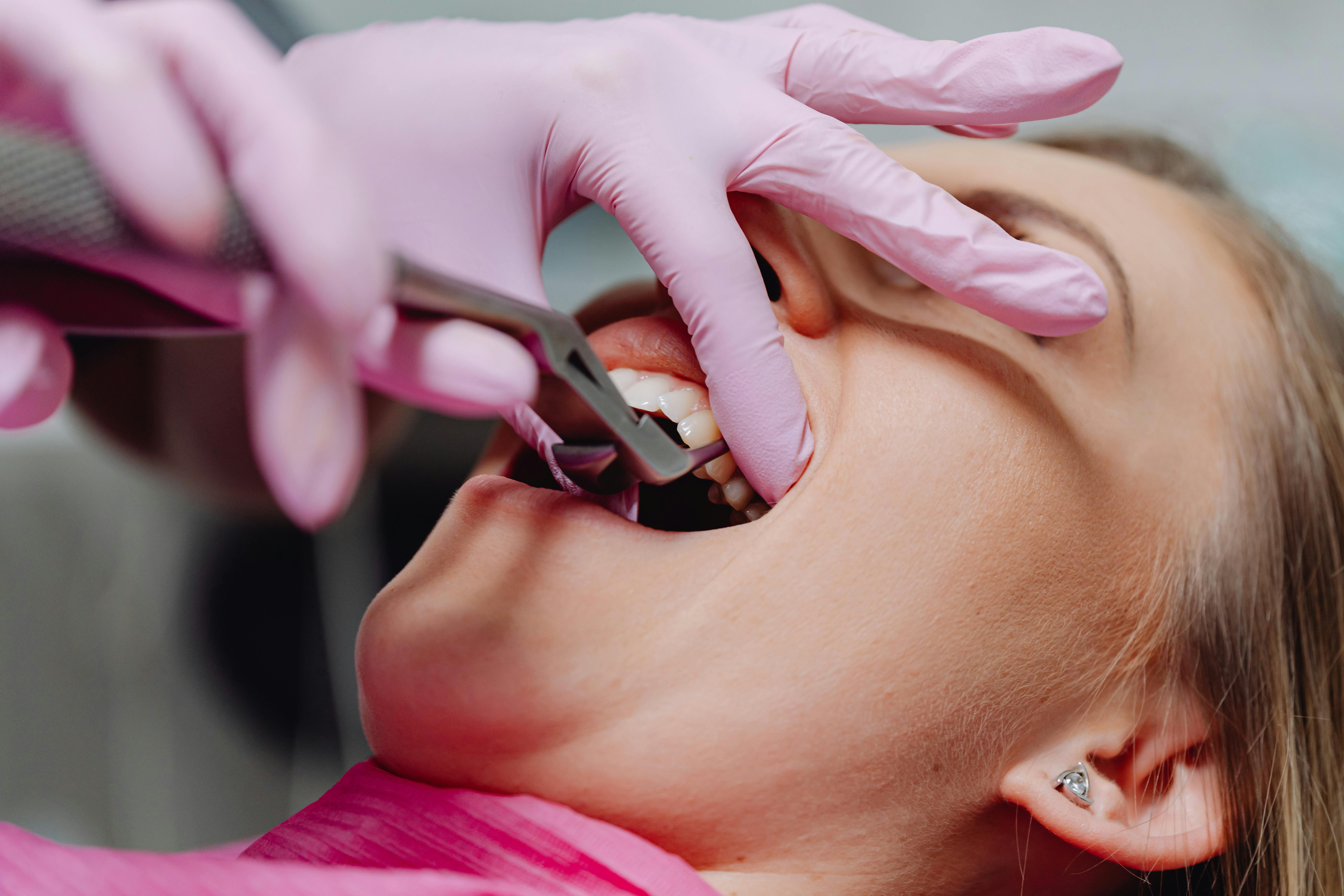 Painless Tooth Removal in Navi Mumbai