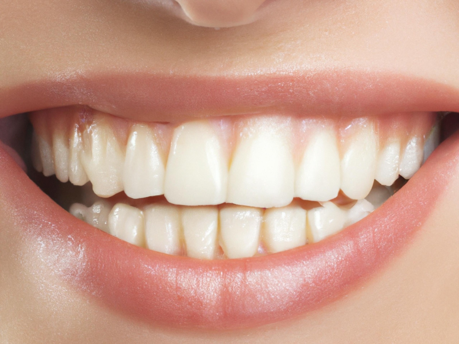 Teeth Cleaning Cost